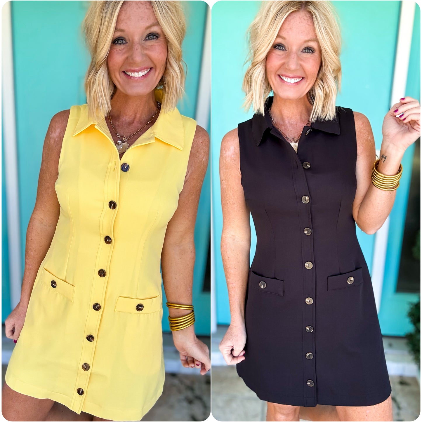 Summer Charm Button Dress